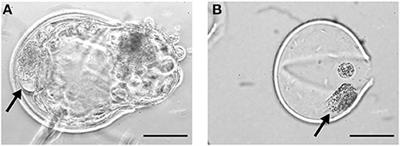 Cellular Fragments in the Perivitelline Space Are Not a Predictor of Expanded Blastocyst Quality